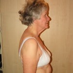 Photograph showing posture issues